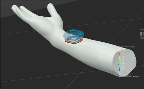 Solidworks CAD design van medische implant