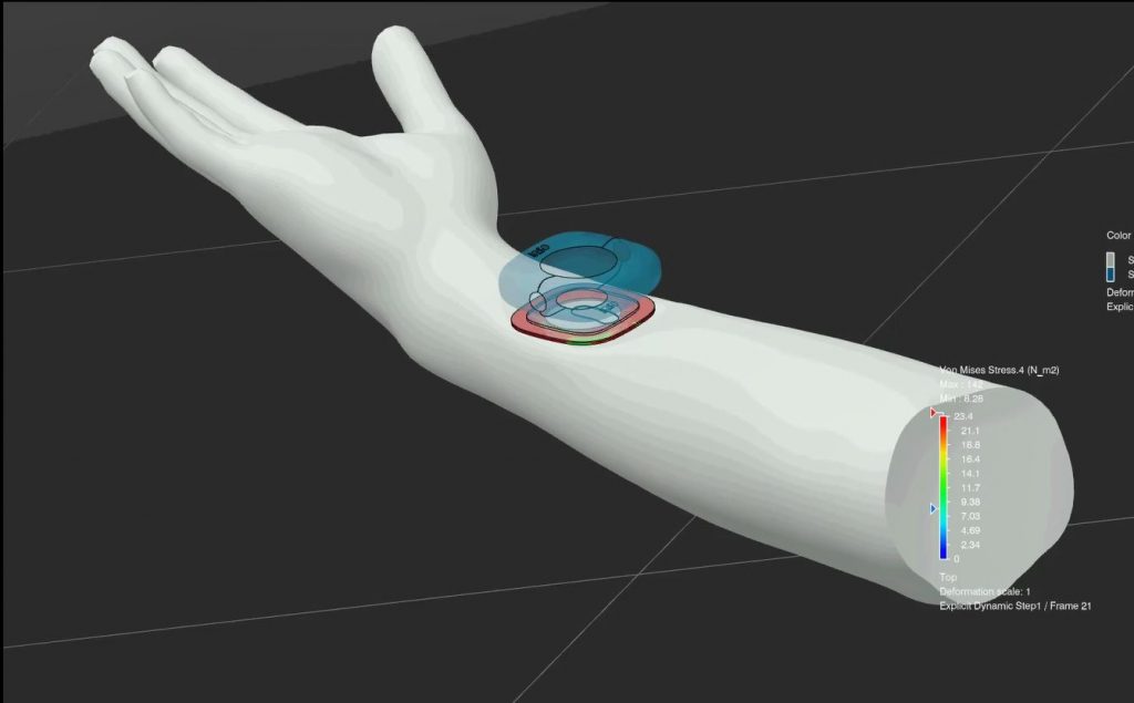 Optimaliseer medische apparaten in de virtuele wereld met Engineered to ...